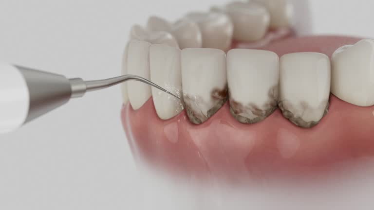Trusted Invisalign Clear Aligners service in Moody, AL - Dentist Open Now